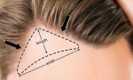 temple_hair_patch_3